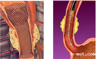 1544325511910220.png 004.png