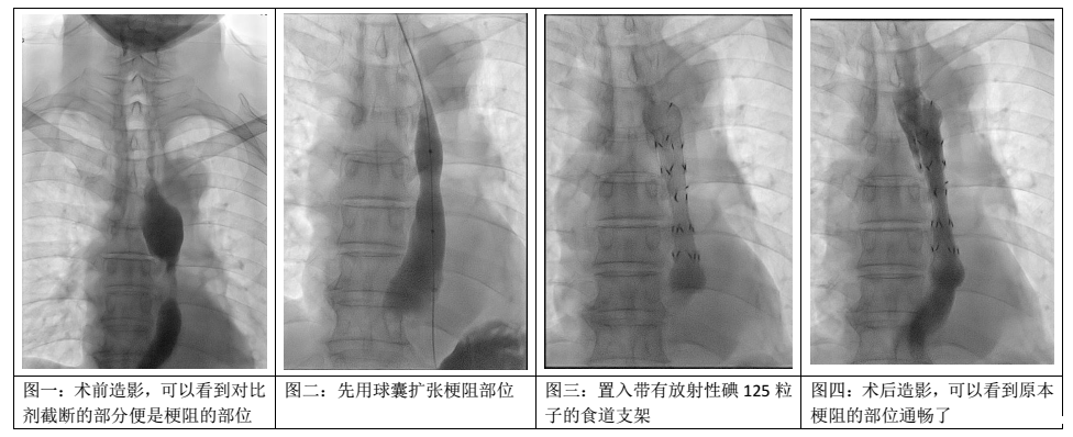 1544328224481594.png 613.png