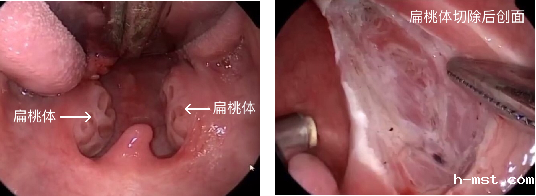 1643258403858426.png image.png